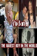 Watch Aidan The Rarest Boy In The World Merdb
