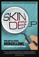 Watch Skin Deep: The Battle Over Morgellons Merdb