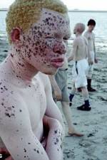 Watch Albino United Merdb