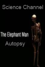 Watch Science Channel Elephant Man Autopsy Merdb