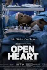 Watch Open Heart Merdb