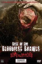 Watch TNA Wrestling: Best of the Bloodiest Brawls - Scars and Stitches Merdb