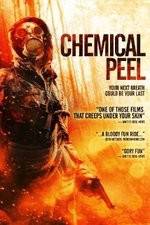 Watch Chemical Peel Merdb