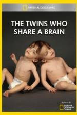 Watch National Geographic The Twins Who Share A Brain Merdb
