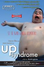Watch Up Syndrome Merdb