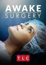 Watch Awake Surgery Merdb