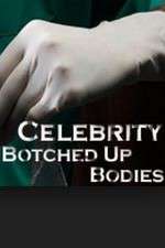 Watch Celebrity Botched Up Bodies Merdb